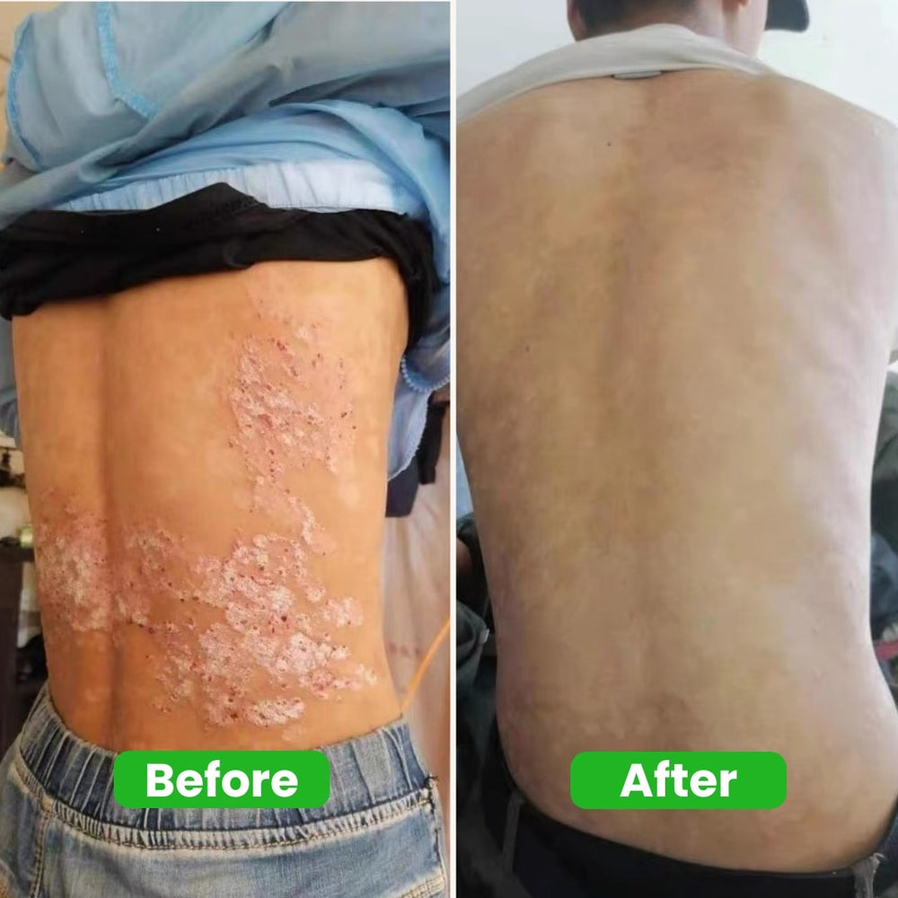 <p>Real People Real Results <br/><em>( 3637 + Happy Customers ! )</em></p>