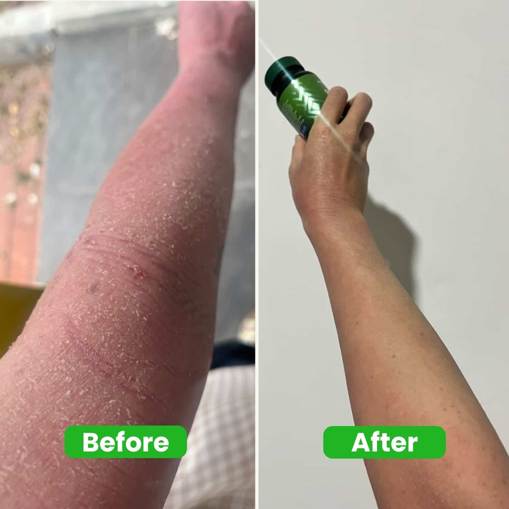 <p>Real People Real Results <br/><em>( 3637 + Happy Customers ! )</em></p>