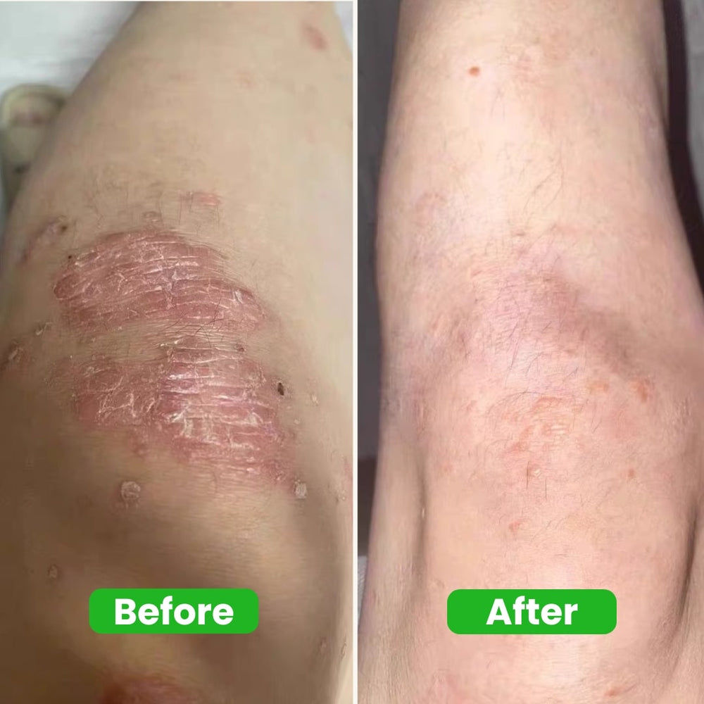 <p>Real People Real Results <br/><em>( 3637 + Happy Customers ! )</em></p>